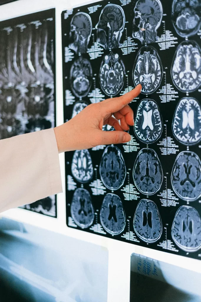 FDA-Approved Medications for Alzheimer’s Disease